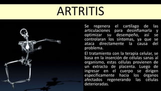 ARTRITIS
Se regenera el cartílago de las
articulaciones para desinflamarla y
optimizar su desempeño, así se
controlaran los síntomas, ya que se
ataca directamente la causa del
problema.
El tratamiento con la terapia celular, se
basa en la inserción de células sanas al
organismo, estas células provienen de
un extracto de placenta. Luego de
ingresar en el cuerpo se dirigen
específicamente hacia los órganos
afectados regenerando las células
deterioradas.
 