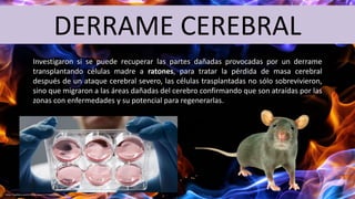DERRAME CEREBRAL
Investigaron si se puede recuperar las partes dañadas provocadas por un derrame
transplantando células madre a ratones, para tratar la pérdida de masa cerebral
después de un ataque cerebral severo, las células trasplantadas no sólo sobrevivieron,
sino que migraron a las áreas dañadas del cerebro confirmando que son atraídas por las
zonas con enfermedades y su potencial para regenerarlas.
 