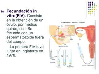 b)

Fecundación in
vitro(FIV). Consiste
en la obtención de un
óvulo, por medios
quirúrgicos. Se
fecunda con un
espermatozoide fuera
del cuerpo.
-La primera FIV tuvo
lugar en Inglaterra en
1978.

 
