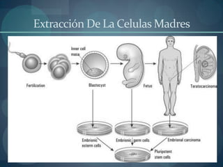 Extracción De La Celulas Madres
 