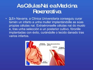 As Células Nai e a Medicina Rexenerativa 3. EnNavarra, a Clínica Universitaria conseguiu curar tamén uninfartoa unha muller implantándolle as súas propias células nai. Extraéronselle células nai do muslo e, tras unha selección e un posterior cultivo, fóronlle implantadas con éxito, curándolle o tecido danado tras varios infartos. 