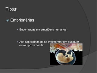 Tipos:
 Embrionárias
 Encontradas em embriõens humanos
 Alta capacidade de se transformar em qualquer
outro tipo de célula
 