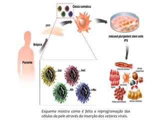 Esquema mostra como é feita a reprogramação das 
células da pele através da inserção dos vetores virais. 
 