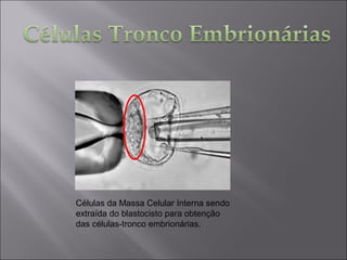 Células da Massa Celular Interna sendo
extraída do blastocisto para obtenção
das células-tronco embrionárias.
 