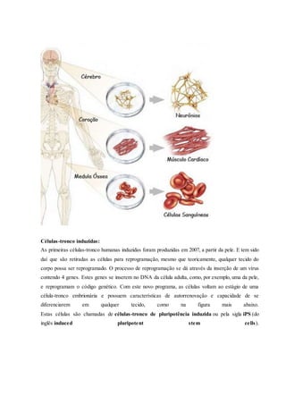 Células-tronco induzidas:
As primeiras células-tronco humanas induzidas foram produzidas em 2007, a partir da pele. E tem sido
daí que são retiradas as células para reprogramação, mesmo que teoricamente, qualquer tecido do
corpo possa ser reprogramado. O processo de reprogramação se dá através da inserção de um vírus
contendo 4 genes. Estes genes se inserem no DNA da célula adulta, como, por exemplo, uma da pele,
e reprogramam o código genético. Com este novo programa, as células voltam ao estágio de uma
célula-tronco embrionária e possuem características de autorrenovação e capacidade de se
diferenciarem em qualquer tecido, como na figura mais abaixo.
Estas células são chamadas de células-tronco de pluripotência induzida ou pela sigla iPS (do
inglês induced pluripotent stem cells).
 