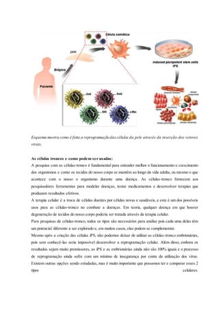 Esquema mostra como é feita a reprogramação dascélulas da pele através da inserção dos vetores
virais.
As células troncos e como podem ser usadas:
A pesquisa com as células-tronco é fundamental para entender melhor o funcionamento e crescimento
dos organismos e como os tecidos do nosso corpo se mantêm ao longo da vida adulta, ou mesmo o que
acontece com o nosso o organismo durante uma doença. As células-tronco fornecem aos
pesquisadores ferramentas para modelar doenças, testar medicamentos e desenvolver terapias que
produzam resultados efetivos.
A terapia celular é a troca de células doentes por células novas e saudáveis, e este é um dos possíveis
usos para as células-tronco no combate a doenças. Em teoria, qualquer doença em que houver
degeneração de tecidos do nosso corpo poderia ser tratada através da terapia celular.
Para pesquisas de células-tronco, todos os tipos são necessários para análise pois cada uma delas têm
um potencial diferente a ser explorado e, em muitos casos, elas podem se complementar.
Mesmo após a criação das células iPS, não podemos deixar de utilizar as células-tronco embrionárias,
pois sem conhecê-las seria impossível desenvolver a reprogramação celular. Além disso, embora os
resultados sejam muito promissores, as iPS e as embrionárias ainda não são 100% iguais e o processo
de reprogramação ainda sofre com um mínimo de insegurança por conta da utilização dos vírus.
Existem outras opções sendo estudadas, mas é muito importante que possamos ter e comparar esses 2
tipos celulares.
 