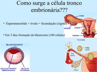 Como surge a célula tronco
embrionária???
• Espermatozóide + óvulo = fecundação (zigoto)
• Em 5 dias formação do blastocisto (100 células)
 