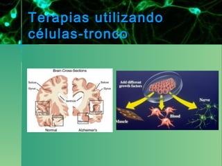 Terapias utilizando
células-tronco
 