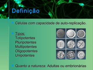 Definição
   Células com capacidade de auto-replicação.

   Tipos:
    Totipotentes
    Pluripotentes
    Multipotentes
    Oligopotentes
    Unipotentes

   Quanto a natureza: Adultas ou embrionárias
 
