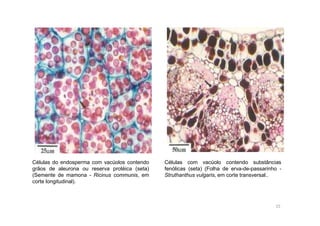 Células do endosperma com vacúolos contendo 
grãos de aleurona ou reserva protéica (seta) 
(Semente de mamona - Ricinus communis, em 
corte longitudinal). 
Células com vacúolo contendo substâncias 
fenólicas (seta) (Folha de erva-de-passarinho - 
Struthanthus vulgaris, em corte transversal.. 
15 
 