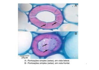A - Pontoações simples (setas), em vista lateral. 
B - Pontoações simples (setas), em vista frontal. 7 
 