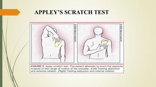 APPLEY’S SCRATCH TEST
 