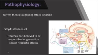Cluster headache l 11 - 2016 | PPSX