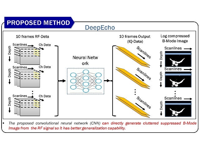 Clutter suppressed deep beamformer for echocardiography using deep ...