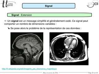 Mise en œuvre du TNS Page 20 sur 64
Signal
Signal : Extension
 Un signal est un message simplifié et généralement codé. Ce signal peut
comporter un nombre de dimensions variables :
 Se pose alors le problème de la représentation de ces données :
http://fr.wikipedia.org/wiki/Imagerie_par_résonance_magnétique
 