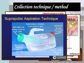 Collection technique / method
 