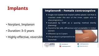 Norplant R2 Comprehensive Overview of Hormonal and Terminal Contraceptive Methods ...