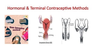 Comprehensive Overview of Hormonal and Terminal Contraceptive Methods ...