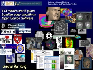 National Library of Medicine
                           Segmentation and Registration Toolkit



$13 million over 6 years
Leading edge algorithms
Open Source Software




www.itk.org
 