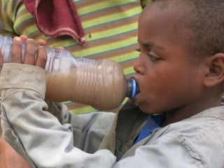CMAM Project in Ethiopia - Community Based Management of Acute Malnutrition