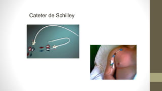 Cateter de Schilley
 