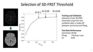 Selection of 3D-FRST Threshold
5
th=0.1
Training and Validation
Selection of the 3D-FRST
threshold using train and
validation data: a trade-off
between sensitivity and FPavg.
Test Data Performance
Sensitivity: 99.4%
FPavg: 276.8 per case
th: 0.09
th=0.09 th=0.08
 