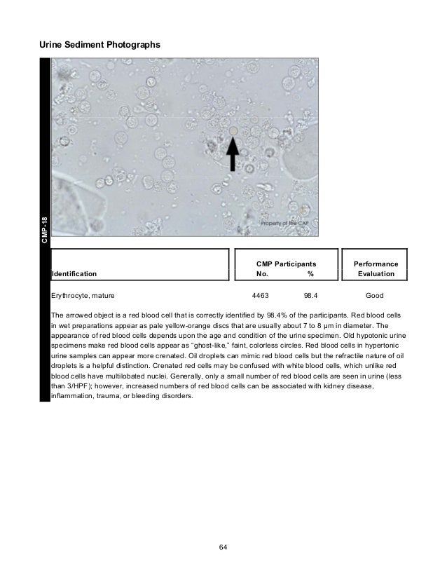 CAP's Survey in Clinical Microscopy 2013
