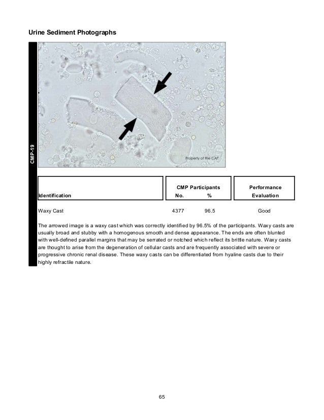 CAP's Survey in Clinical Microscopy 2013