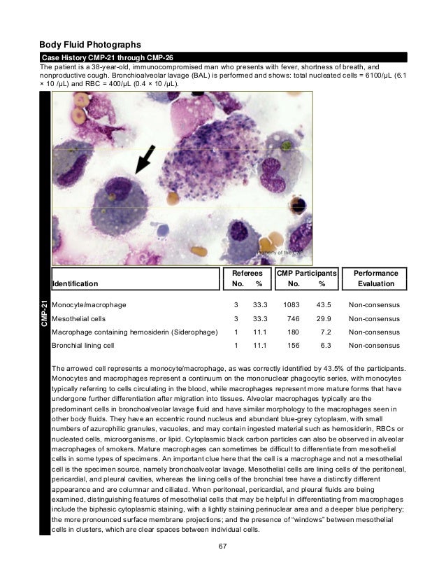 CAP's Survey in Clinical Microscopy 2013