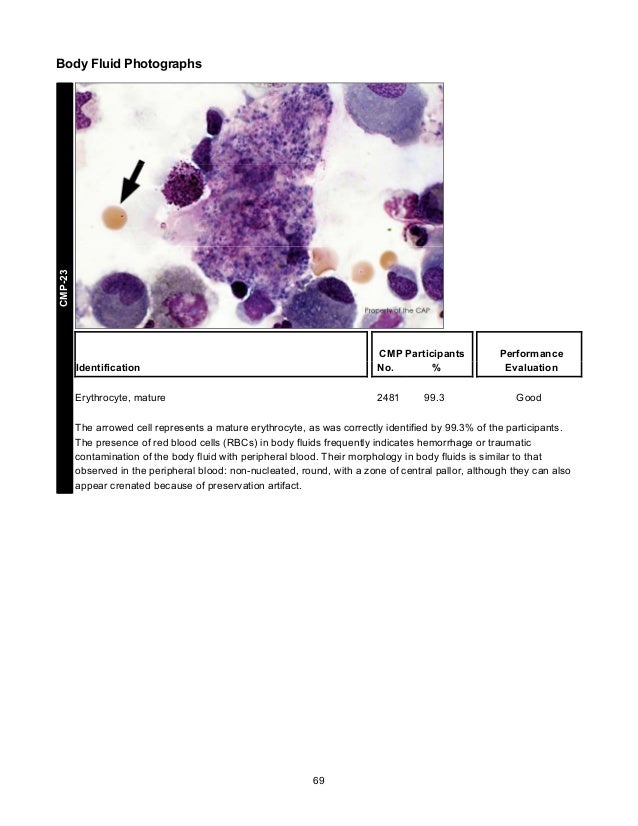 CAP's Survey in Clinical Microscopy 2013