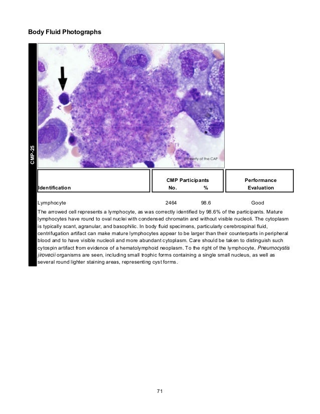 CAP's Survey in Clinical Microscopy 2013
