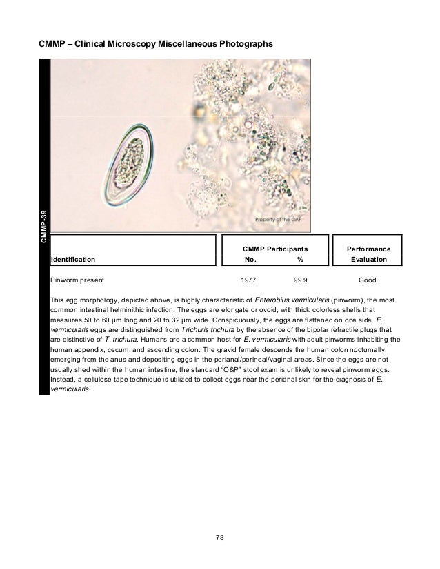 CAP's Survey in Clinical Microscopy 2013