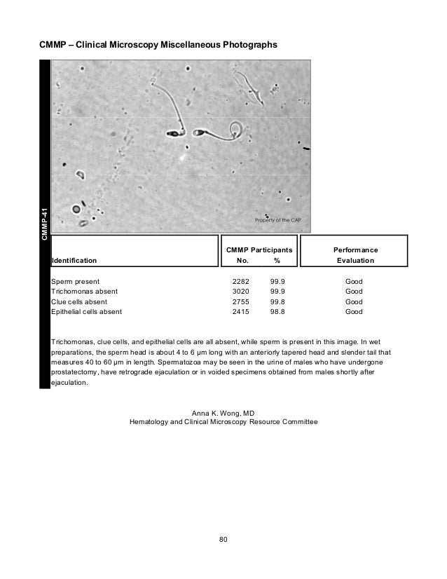 CAP's Survey in Clinical Microscopy 2013
