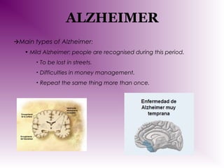 ALZHEIMER
Main types of Alzheimer:
• Mild Alzheimer: people are recognised during this period.
•

To be lost in streets.

•

Difficulties in money management.

•

Repeat the same thing more than once.

 