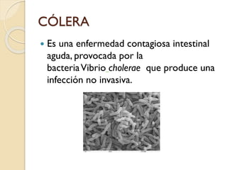 CÓLERA


Es una enfermedad contagiosa intestinal
aguda, provocada por la
bacteria Vibrio cholerae que produce una
infección no invasiva.

 