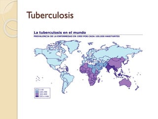 Tuberculosis

 