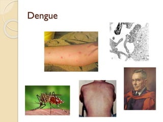 Dengue

 