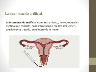 Lainseminaciónartificial.
La Inseminación Artificial es un tratamiento, de reproducción
asistida que consiste, en la introducción médica del semen,
previamente tratado, en el útero de la mujer.
 