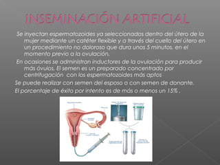  Se inyectan espermatozoides ya seleccionados dentro del útero de la
mujer mediante un catéter flexible y a través del cuello del útero en
un procedimiento no doloroso que dura unos 5 minutos, en el
momento previo a la ovulación.
En ocasiones se administran inductores de la ovulación para producir
más óvulos. El semen es un preparado concentrado por
centrifugación con los espermatozoides más aptos
Se puede realizar con semen del esposo o con semen de donante.
El porcentaje de éxito por intento es de más o menos un 15% .
 