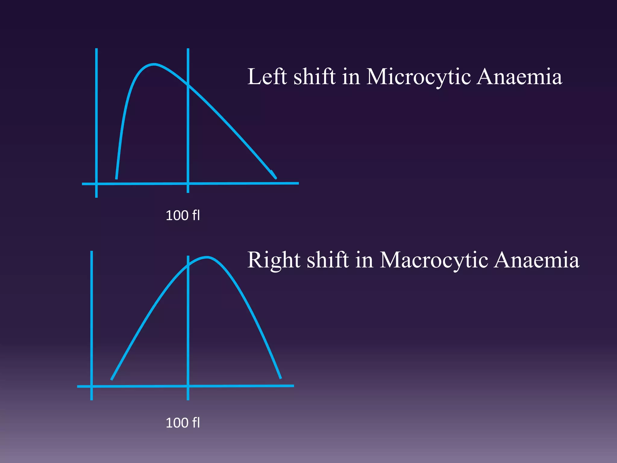 100 fl
100 fl
Left shift in Microcytic Anaemia
Right shift in Macrocytic Anaemia
 