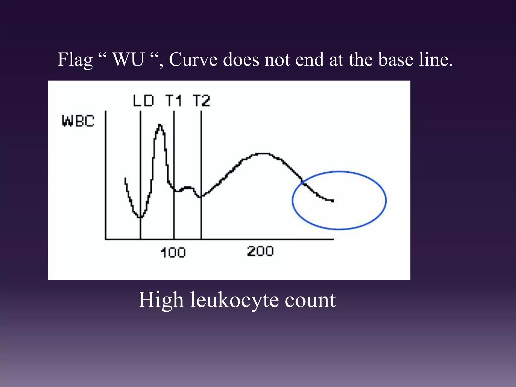 Flag “ WU “, Curve does not end at the base line.
High leukocyte count
 