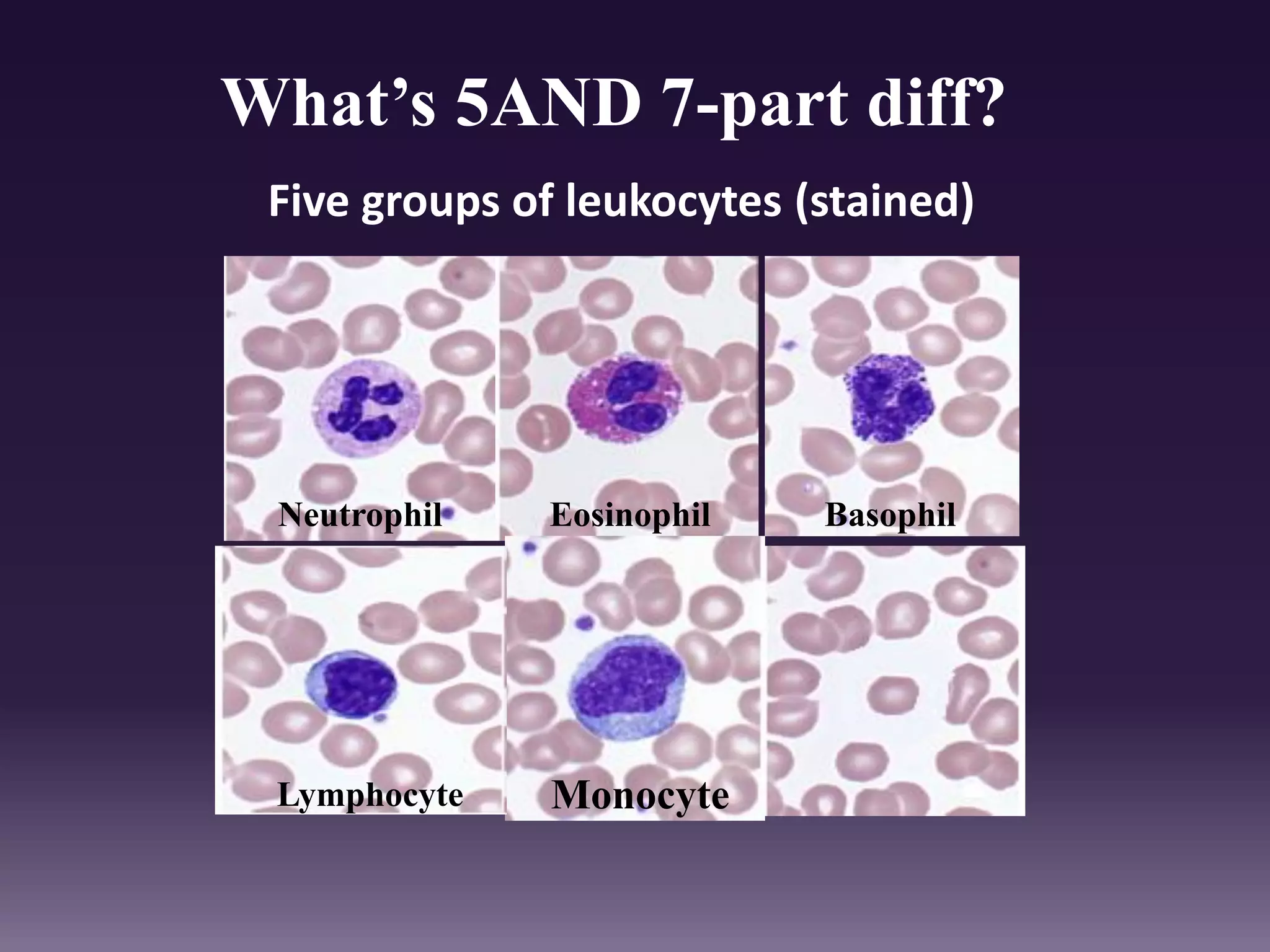 Five groups of leukocytes (stained)
What’s 5AND 7-part diff?
Neutrophil Eosinophil Basophil
Lymphocyte Monocyte
 