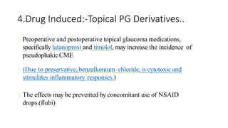 4.Drug Induced:-Topical PG Derivatives..
Preoperative and postoperative topical glaucoma medications,
specifically latanoprost and timolol, may increase the incidence of
pseudophakicCME.
(Due to preservative, benzalkonium chloride, is cytotoxic and
stimulates inflammatory responses.)
The effects may be prevented by concomitant use of NSAID
drops.(flubi)
 