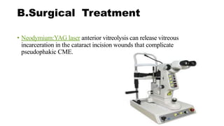 B.Surgical Treatment
• Neodymium:YAG laser anterior vitreolysis can release vitreous
incarceration in the cataract incision wounds that complicate
pseudophakic CME.
 