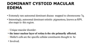 DOMINANT CYSTOID MACULAR
EDEMA
• Extremely rare autosomal dominant disease mapped to chromosome 7q.
• Interestingly, autosomal dominant retinitis pigmentosa, known as RP9,
also maps to this region.
Unique macular disorder-
• the inner nuclear layer of retina is the site primarily affected.
Muller's cells are the specific cellular constituents thought to be
• Involved.
 
