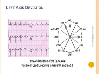 Cardiac monitoring & ECG | PPTX