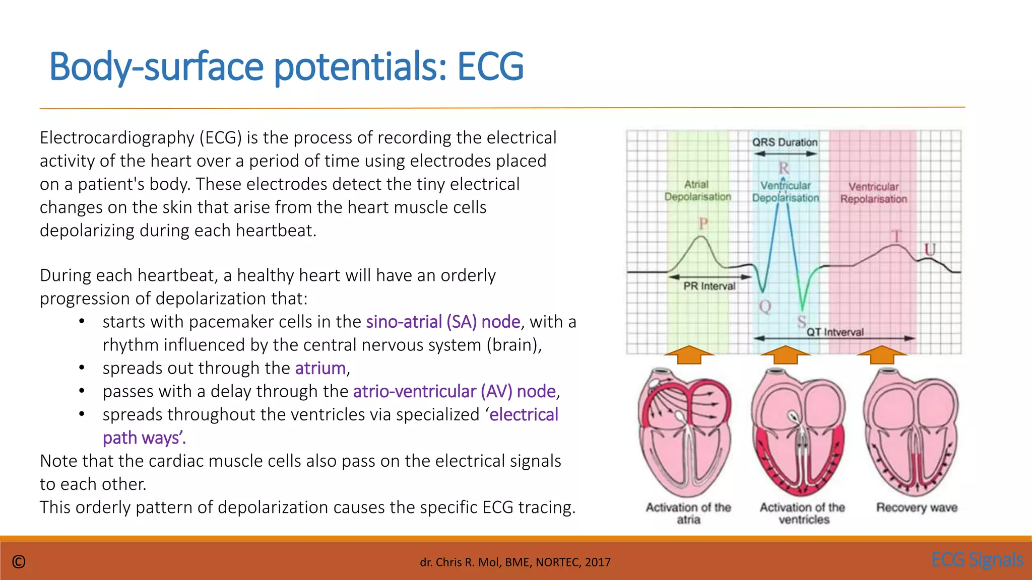 CM ECG Signals pp.pptx