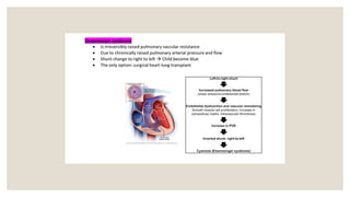 Comprehensive Overview of Common Congenital Heart Diseases in Children ...