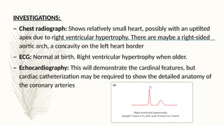 Comprehensive Overview of Common Congenital Heart Diseases in Children ...
