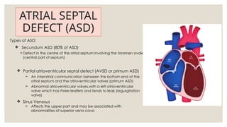 Comprehensive Overview of Common Congenital Heart Diseases in Children ...